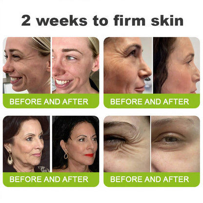 🧠👨‍⚕️Made and shipped from the USA 💫LOVILDS® Skin Tightening & Vita-A Retinol Retinol shot Anti-Wrinkle Firming Tightening cream - Last Day Promotion 70% OFF