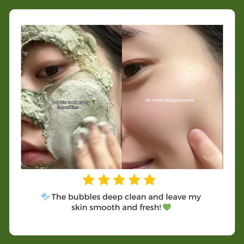 Skavix™ - Foam Cleansing Deep Cleansing Mask