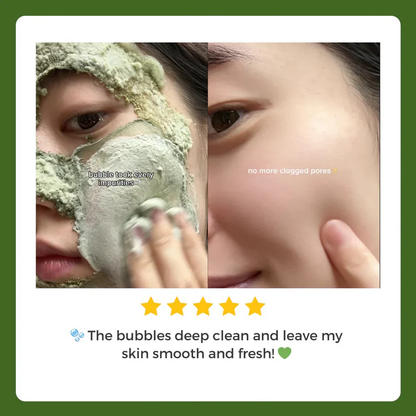 Skavix™ - Foam Cleansing Deep Cleansing Mask
