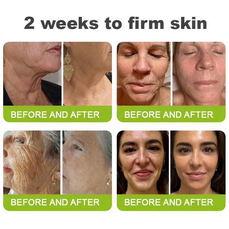 🧠👨‍⚕️Made and shipped from the USA 💫LOVILDS® Skin Tightening & Vita-A Retinol Retinol shot Anti-Wrinkle Firming Tightening cream - Last Day Promotion 70% OFF