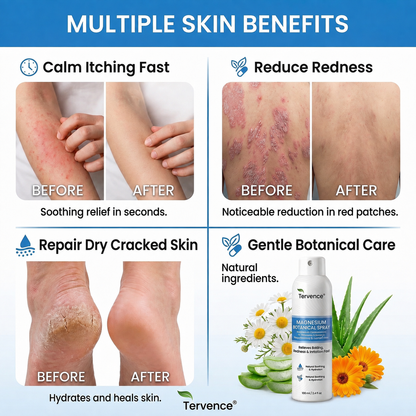 ✨Tervence® Magnesium Botanical Spray –  Advanced Skin Recovery for Psoriasis & Eczema | Rapid Soothing, Steroid-Free