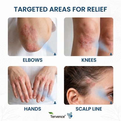 ✨Tervence® Magnesium Botanical Spray –  Advanced Skin Recovery for Psoriasis & Eczema | Rapid Soothing, Steroid-Free