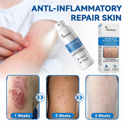 ✨Tervence® Magnesium Botanical Spray –  Advanced Skin Recovery for Psoriasis & Eczema | Rapid Soothing, Steroid-Free