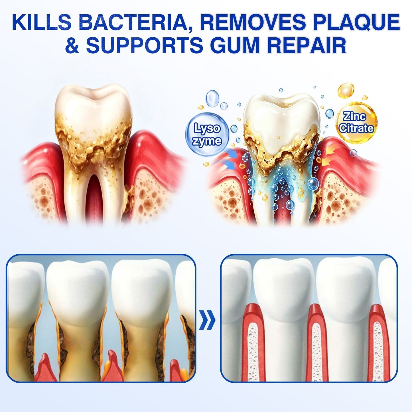 🇬🇧👨‍⚕️🦷🛡️BBOJI® GumRevive Periodontal Repair Gel
