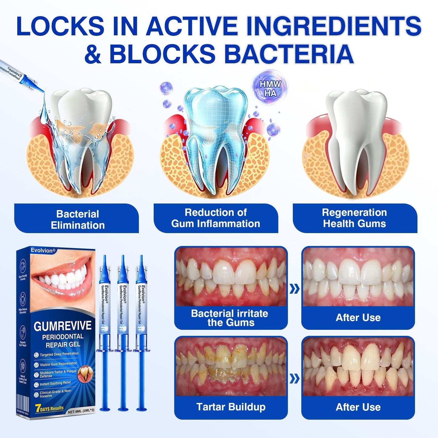 🇬🇧👨‍⚕️🦷🛡️BBOJI® GumRevive Periodontal Repair Gel