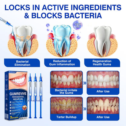🇬🇧👨‍⚕️🦷🛡️BBOJI® GumRevive Periodontal Repair Gel