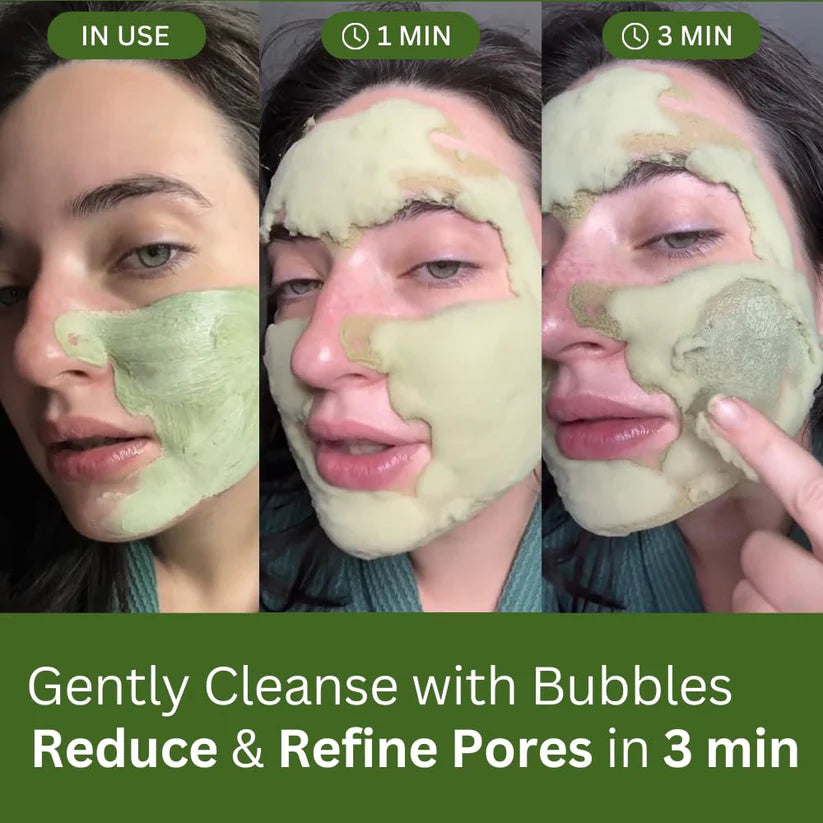 Skavix™ - Foam Cleansing Deep Cleansing Mask