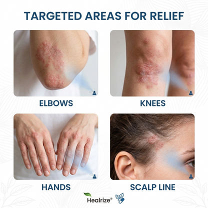 ✨Tervence® Magnesium Botanical Spray –  Advanced Skin Recovery for Psoriasis & Eczema | Rapid Soothing, Steroid-Free