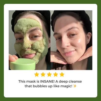Skavix™ - Foam Cleansing Deep Cleansing Mask