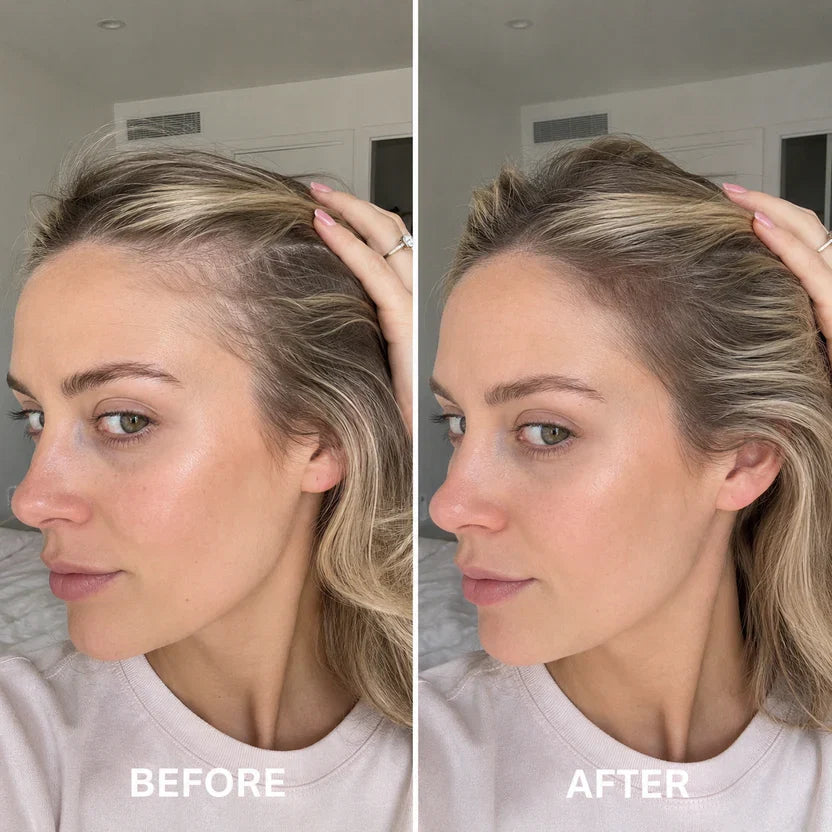 Deoxyribose Scalp Serum